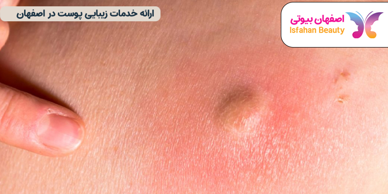 شکل کورک، ظاهر کورک