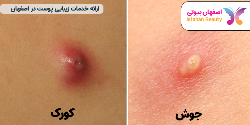 فرق جوش و کورک