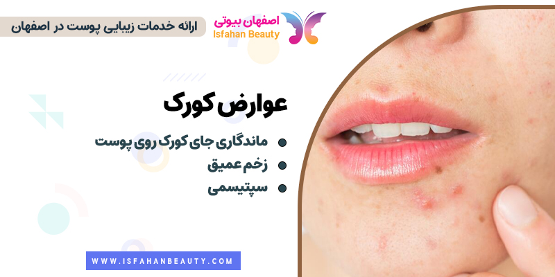 عوارض کورک، خطرات کورک