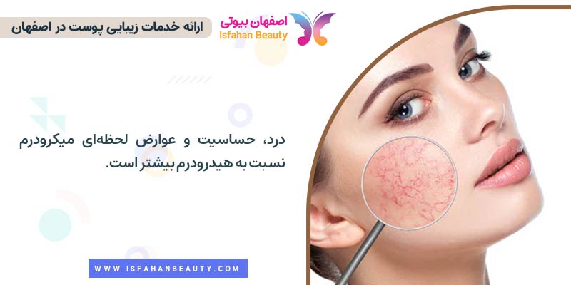 درد بین میکرودرم و هیدرودرم