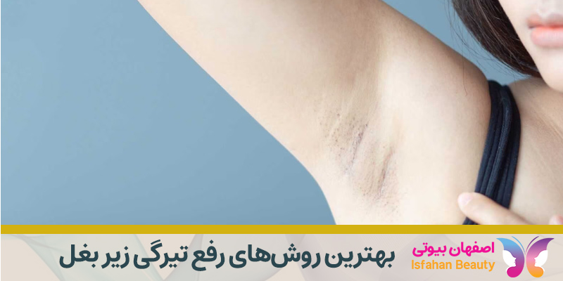 بهترین روش درمان سیاهی زیر بغل