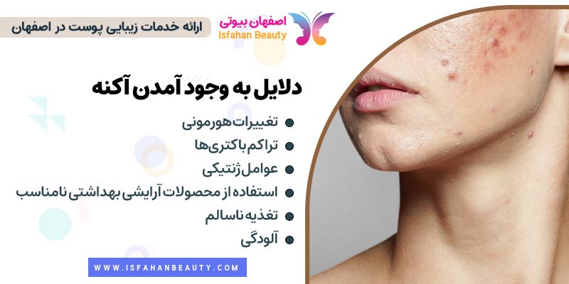 دلایل به وجود آمدن آکنه، علت آکنه پوستی