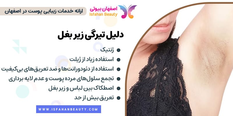 دلیل تیرگی زیر بغل