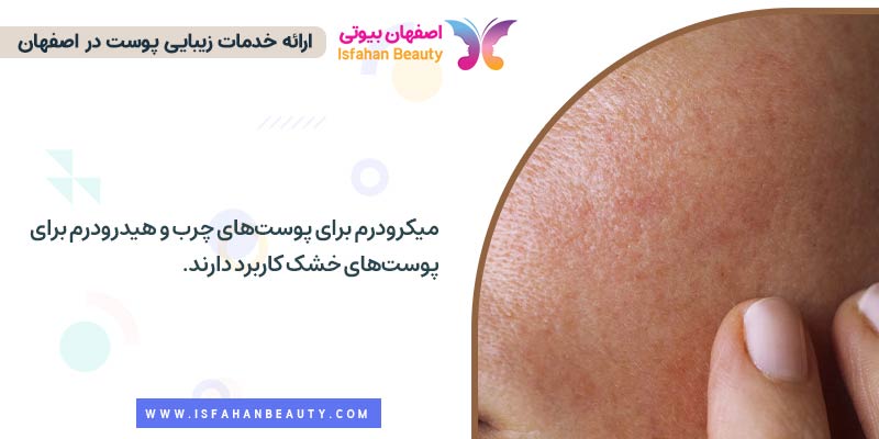 میکرودرم برای کدام پوست مناسب است؟ هیدرودرم برای کدام پوست مناسب است؟