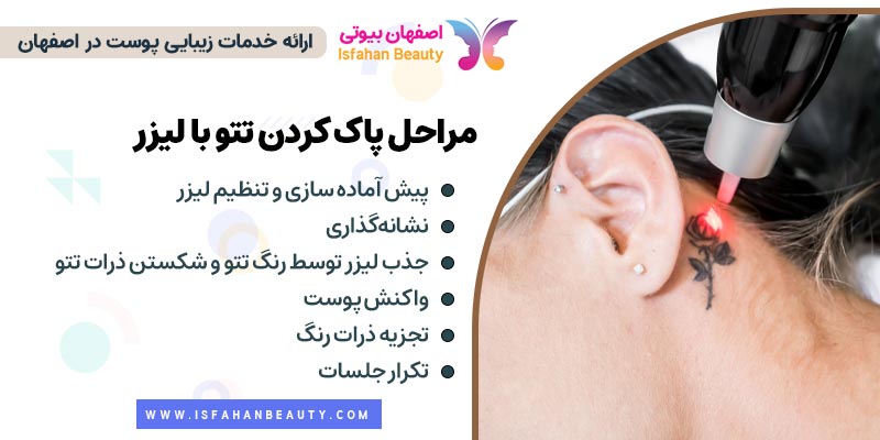 مراحل پاک کردن تتو با لیزر