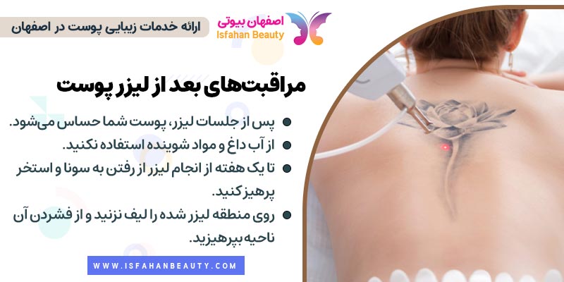 مراقبت های بعد از پاک کردن تتو با لیزر