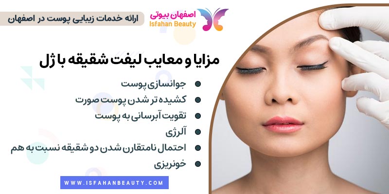 مزایا و معایب لیفت شقیقه با ژل و فیلر