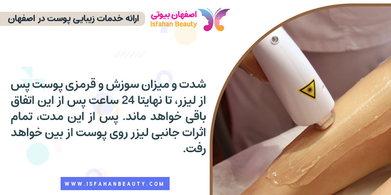 کمتر شدن شدت درد لیزر موهای زائد