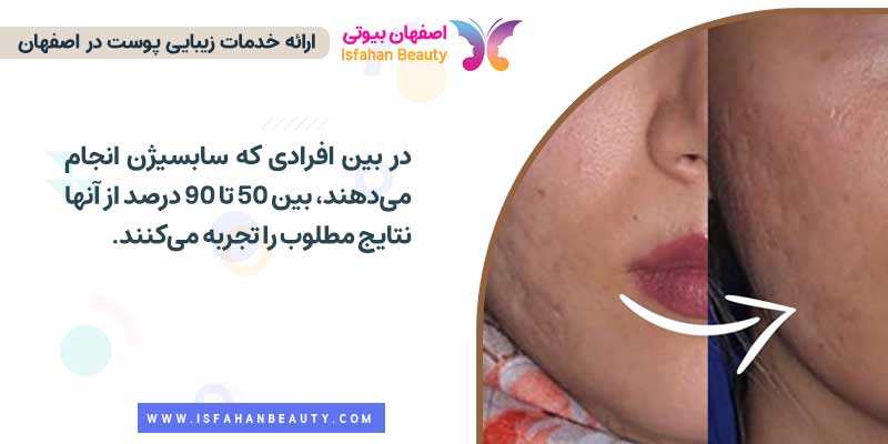 سابسیژن چند درصد جواب میده؟
