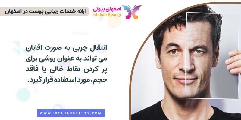 فواید انتقال چربی صورت برای مردان