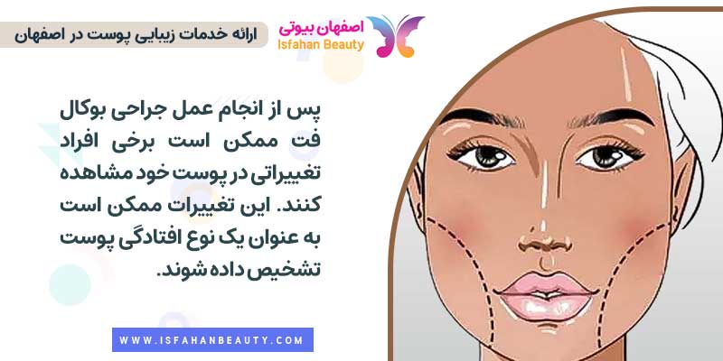 بوکال فت و افتادگی پوست