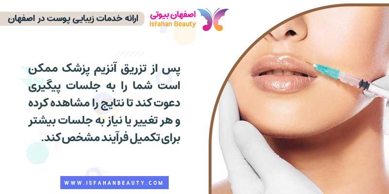 مراحل تزریق آنزیم برای تخلیه ژل