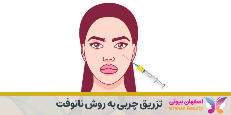 تزریق چربی به روش نانوفت | نانوفت چیست و چه کاربردی دارد؟