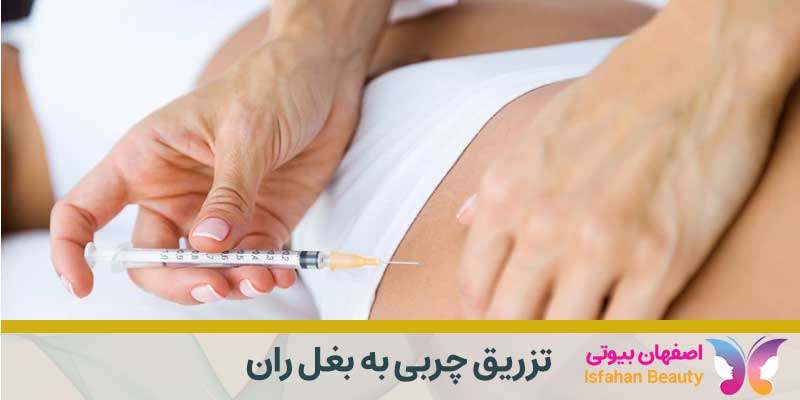 تزریق چربی به بغل ران| قیمت تزریق چربی به بغل ران در اصفهان
