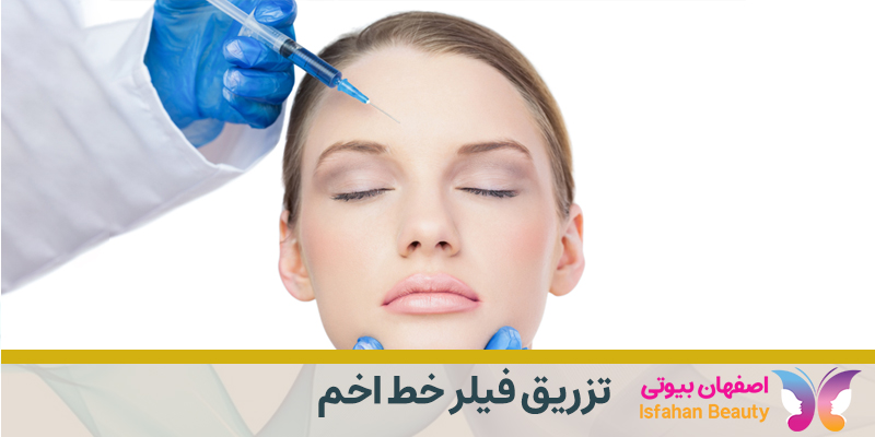 تزریق فیلر خط اخم