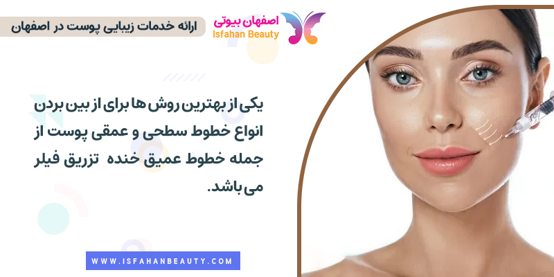 تزریق فیلر یکی از بهترین روش ها برای کاهش خط خنده است