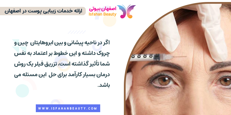 تزریق فیلر برای کاهش چین و چروک های خط اخم