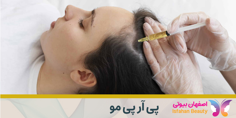روش پی آر پی مو