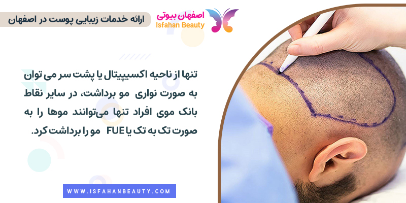 تنها از پشت سر می توان مو را به صورت نواری برداشت