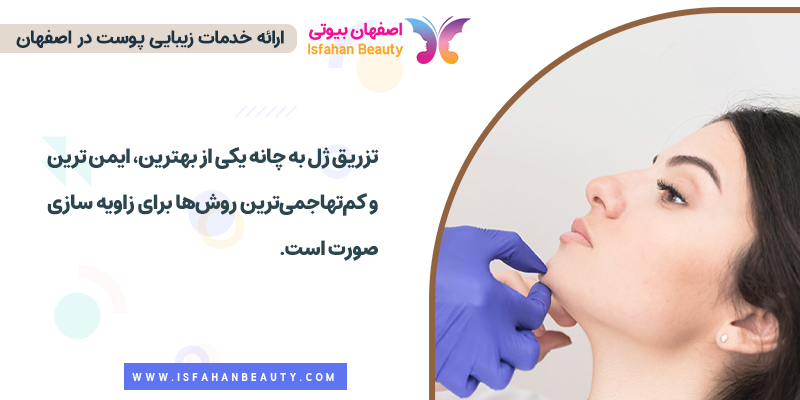 تزریق ژل به چانه برای زاویه سازی صورت