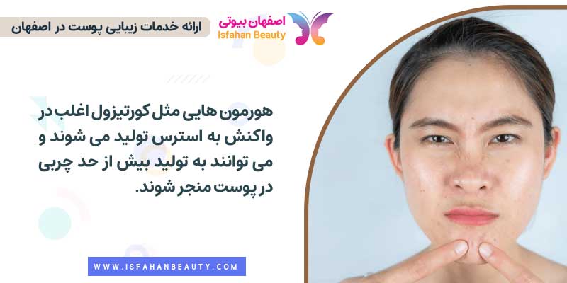 چه هورمونی باعث چرب شدن پوست میشود؟