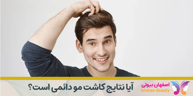 آیا نتایج کاشت مو دائمی است؟
