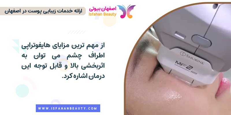 مزایای هایفوتراپی اطراف چشم