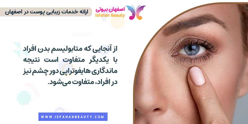 ماندگاری هایفو زیر چشم