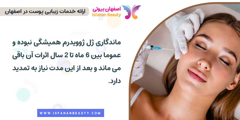 ماندگاری ژل ژوویدرم