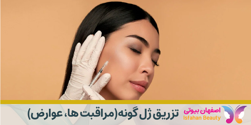 تزریق ژل گونه