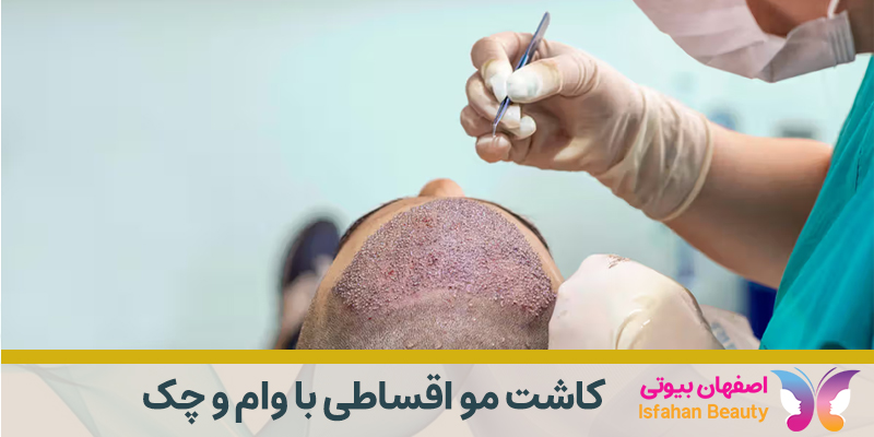 کاشت مو اقساطی با وام و چک در اصفهان
