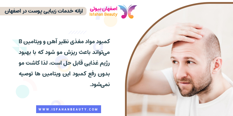 افرادی که به خطر کمبود ویتامین دچار ریزش مو شده اند تا زمان برطرف نکردن این مشکل نمی توانند کاشت مو انجام دهند