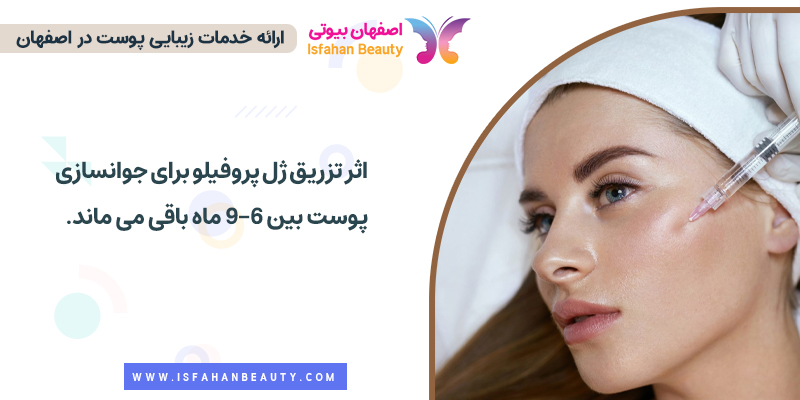 ماندگاری ژل پروفایلو