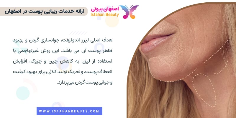هدف اصلی لیزر اندولیفت گردن