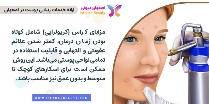 درمان اسکار آکنه با کراس