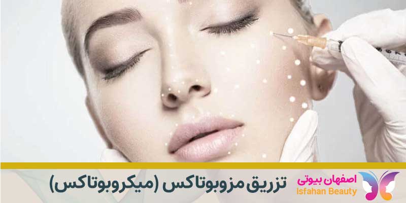 تزریق مزوبوتاکس جوانسازی در اصفهان (میکروبوتاکس)