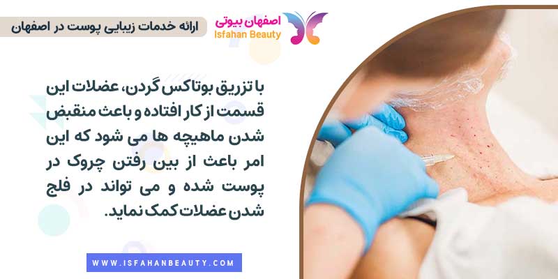 بوتاکس گردن چیست و برای چه افرادی مناسب است؟