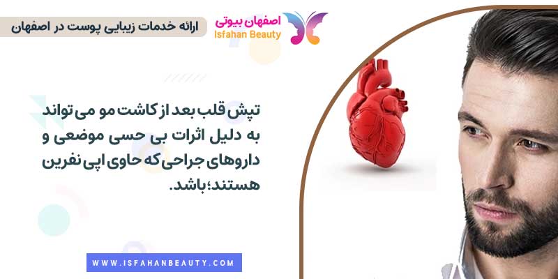 تپش قلب بعد از کاشت مو