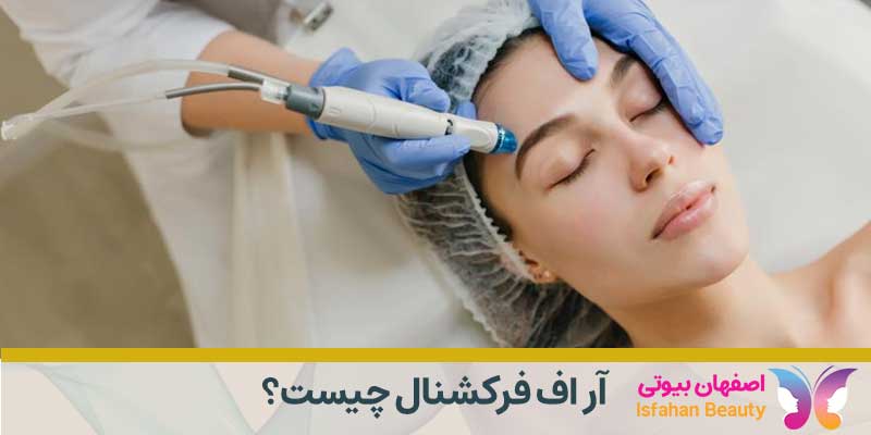 آر اف فرکشنال چیست؟