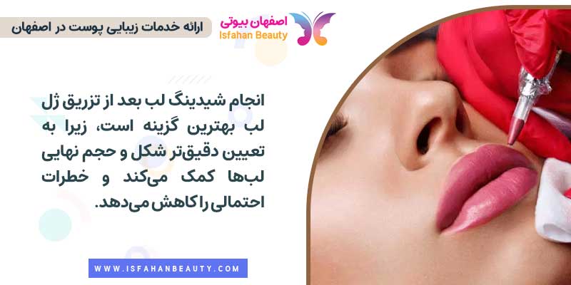 تاتو لب بعد از تزریق فیلر