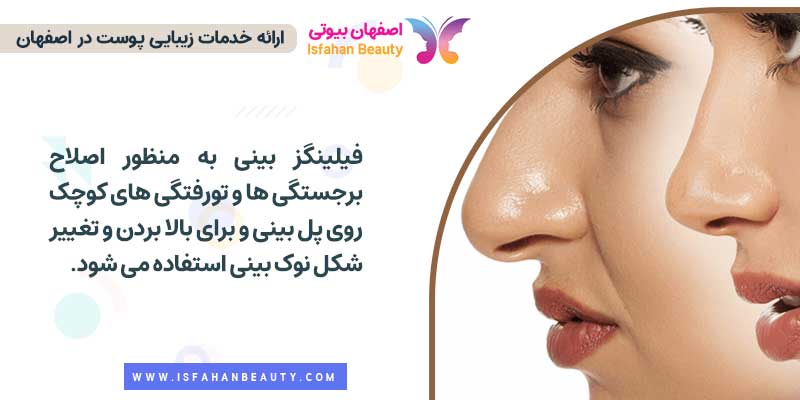 فیلینگز بینی در اصفهان