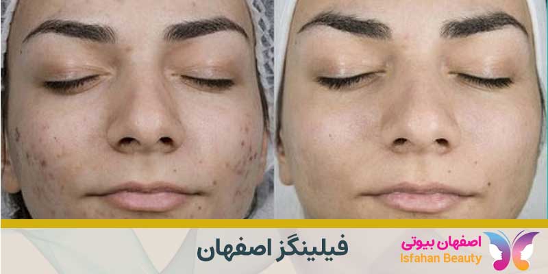 فیلینگز اصفهان