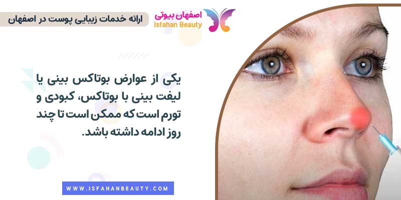 عوارض بوتاکس بینی