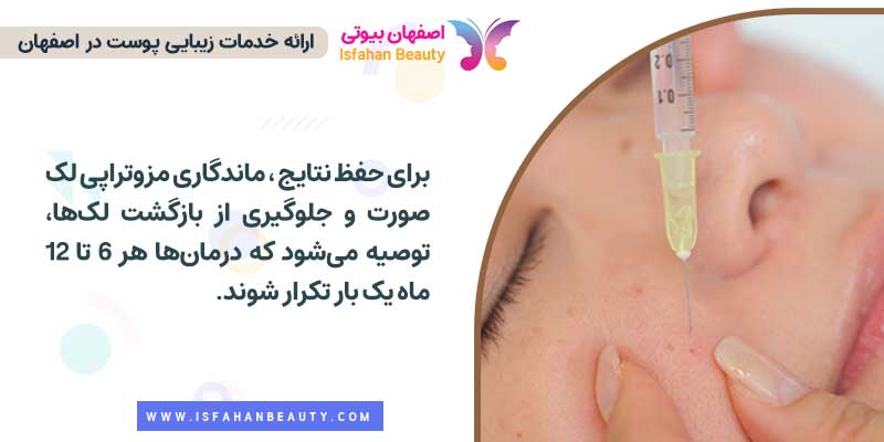ماندگاری مزوتراپی لک صورت