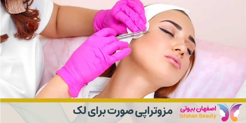 مزوتراپی صورت برای لک | بهترین دکتر برای درمان لک صورت در اصفهان