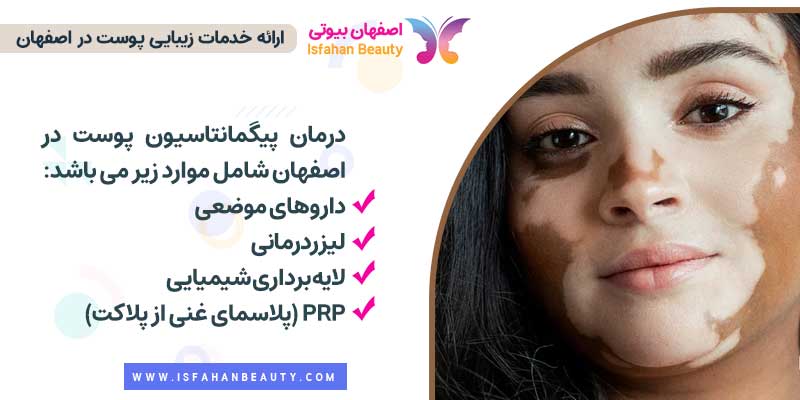 درمان پیگمانتاسیون پوست در اصفهان