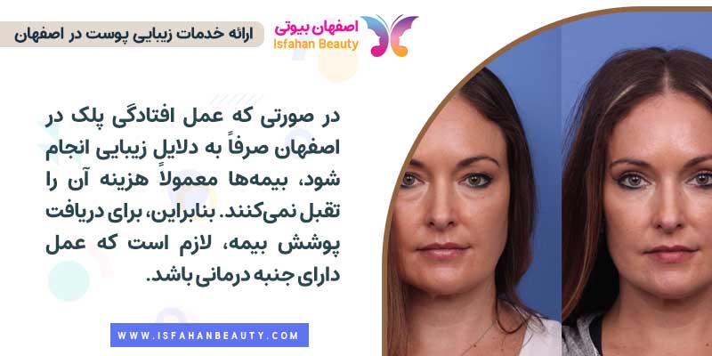 پرداخت هزینه عمل افتادگی پلک در اصفهان با بیمه امکان پذیر است؟