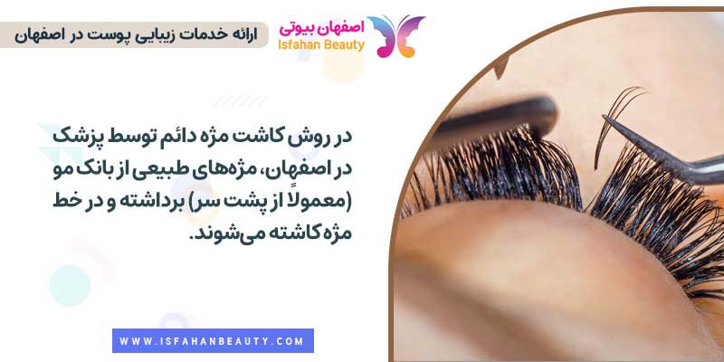 کاشت مژه دائم توسط پزشک در اصفهان