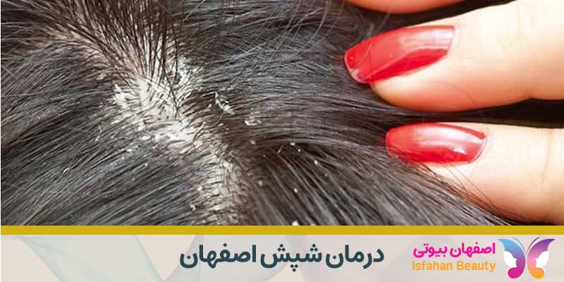 کلینیک درمان شپش اصفهان