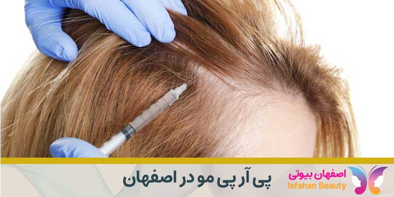 پی آر پی مو در اصفهان